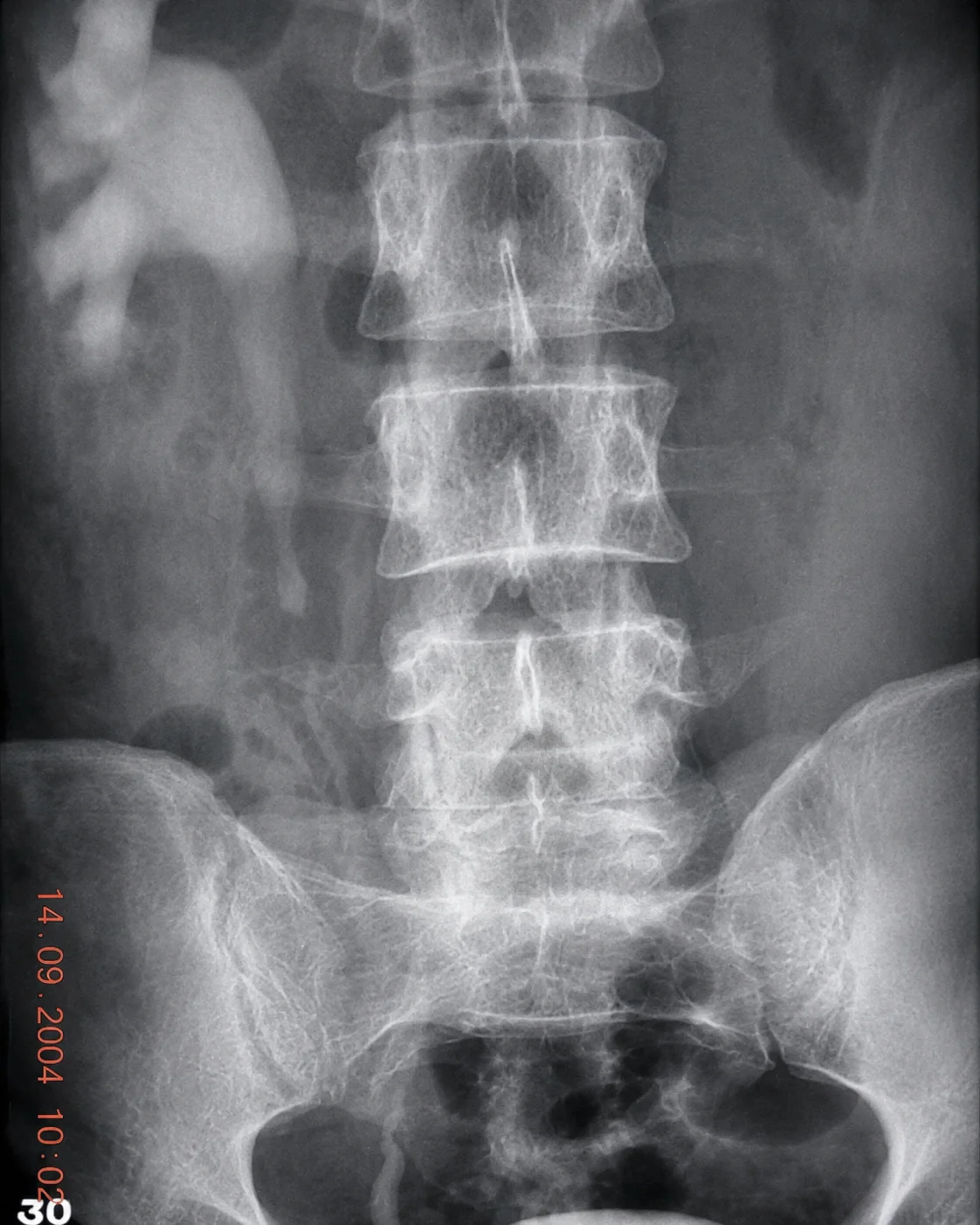 B2 image
