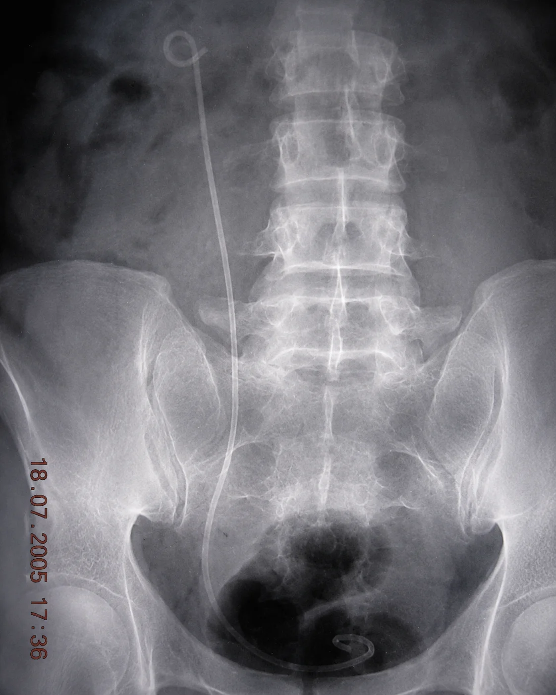 B3 image