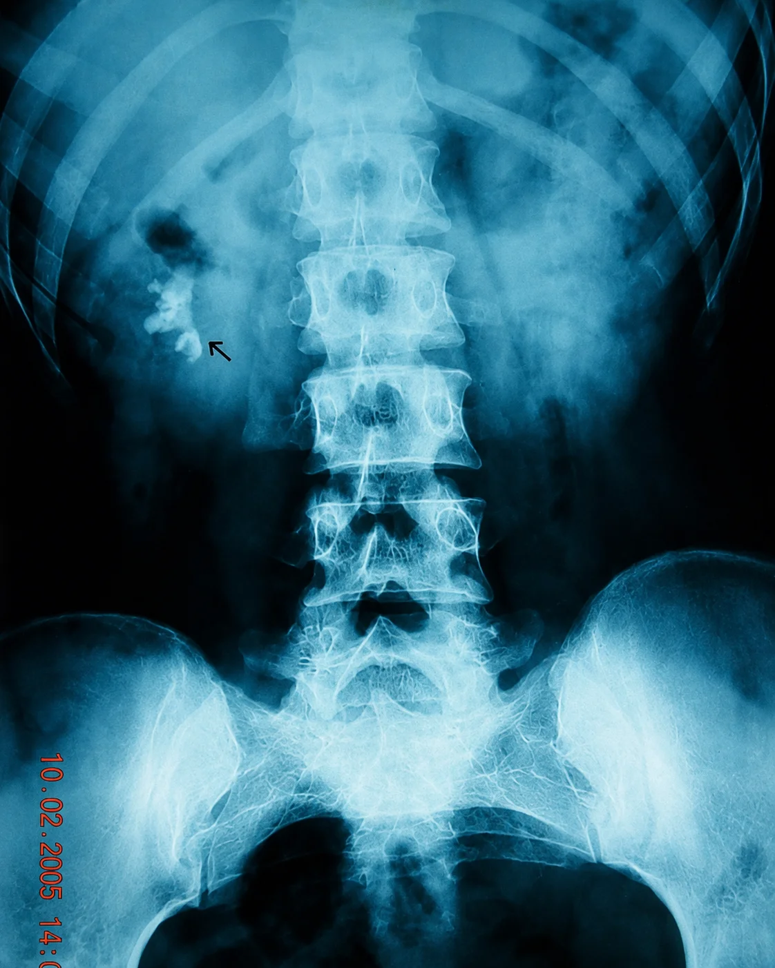 Ba image