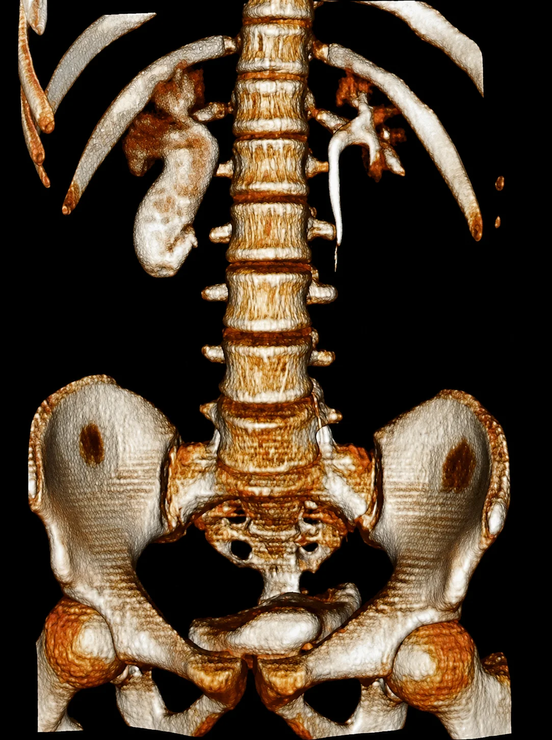 Backbone image
